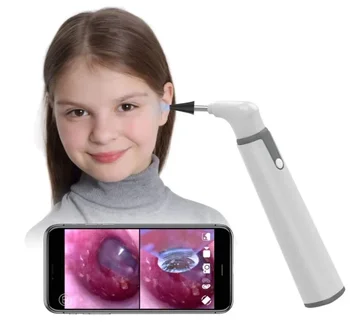 3.9 mm wifi vizualne digitalni otoscope uho endoskop fotoaparat uho vosek čistilo kamera za ušesa, nos zobni podpora ios androidov